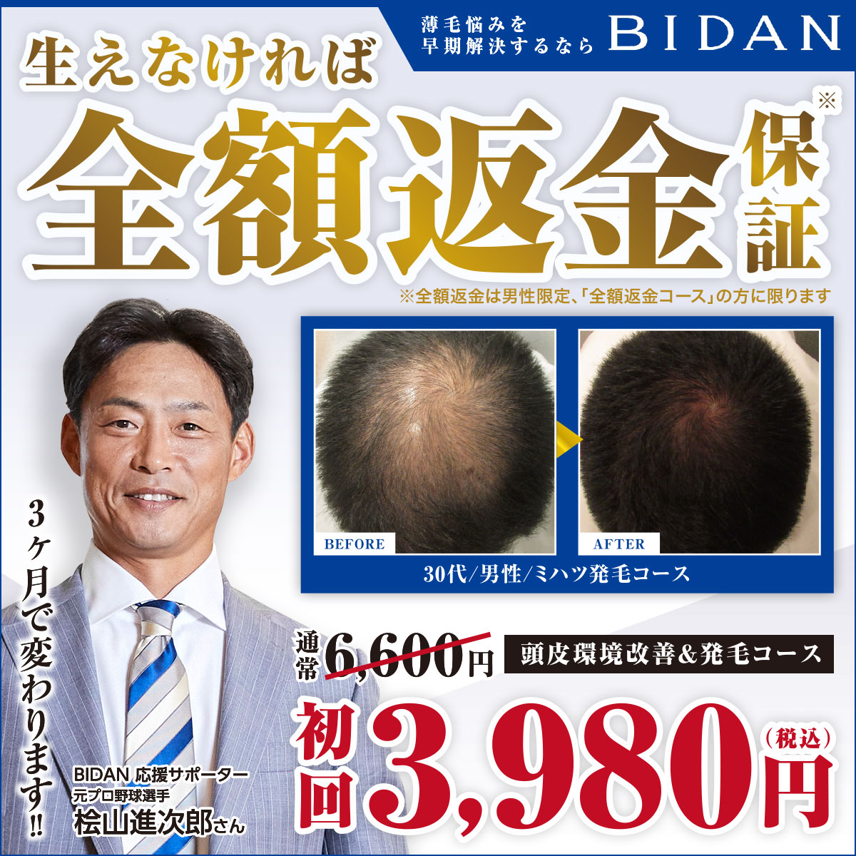 BIDAN(ビダン)発毛サロン｜生えなければ全額返金保証、頭皮環境改善&発毛コース初回3,980円のキャンペーンバナー